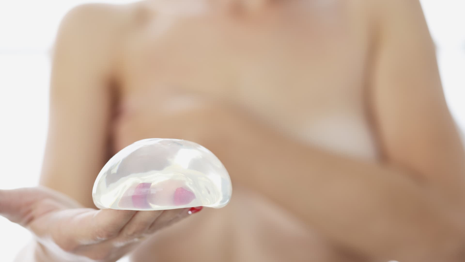 Breast Augmentation